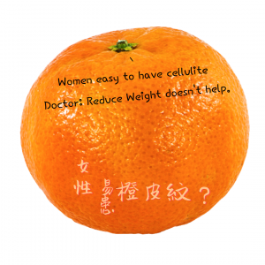 Women Easy to Have Cellulite